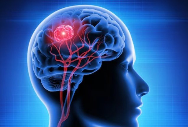 Epilepsy Treatment in Jalalabad